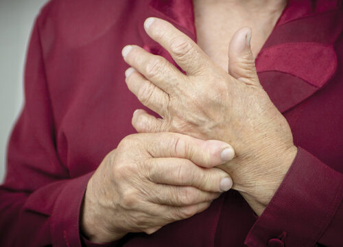 Rheumatologic Disorder