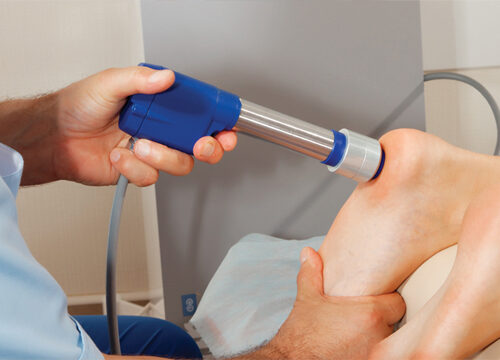 ESWT – Extracorporeal Shock Wave Therapy