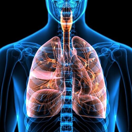 COPD (Chronic Obstructive Pulmonary Disease)